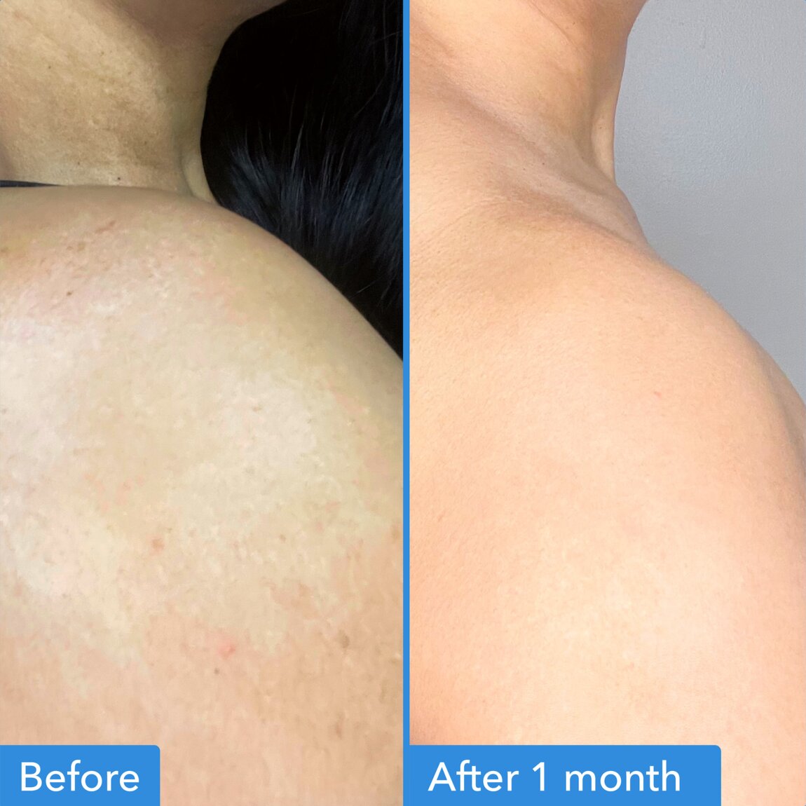 discoloration-correcting-body-treatment-f0 zb_p.jpg