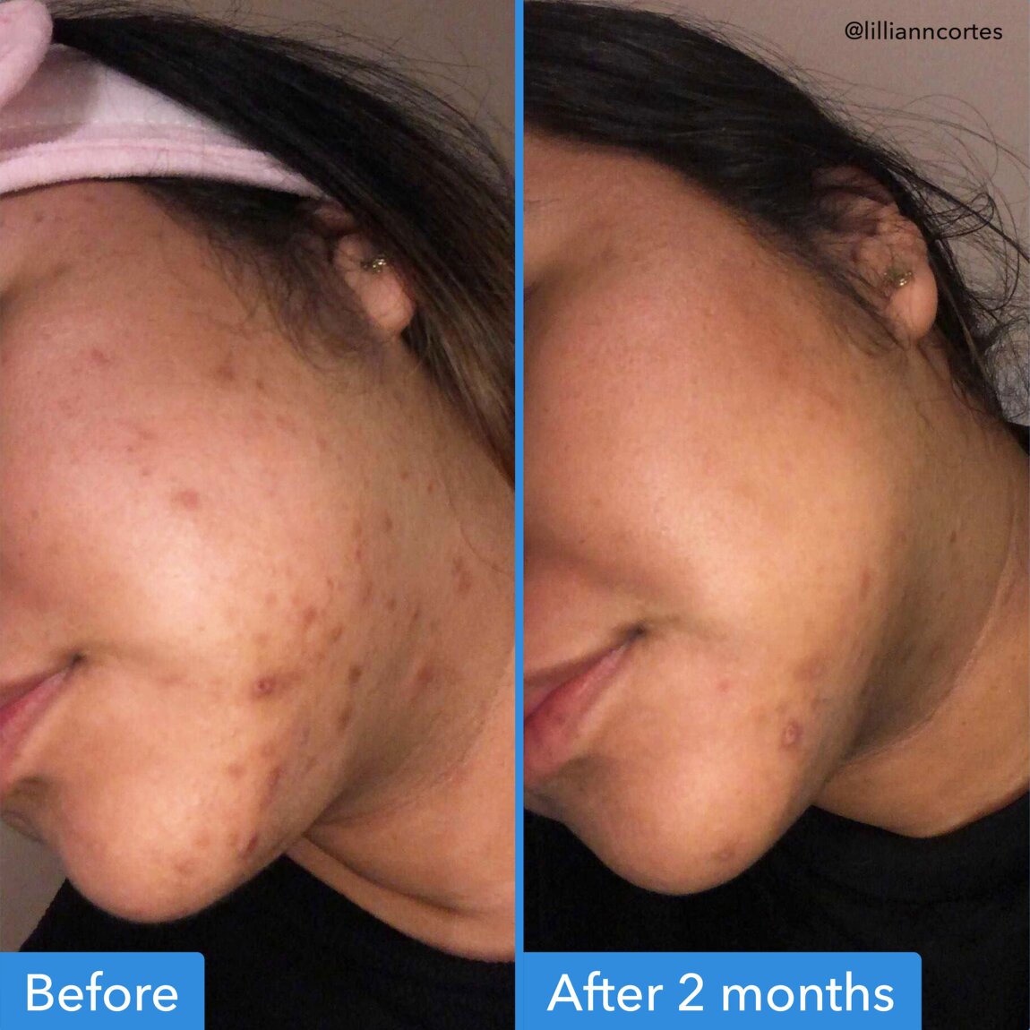 discoloration-correcting-serum-g1 zb_p.jpg
